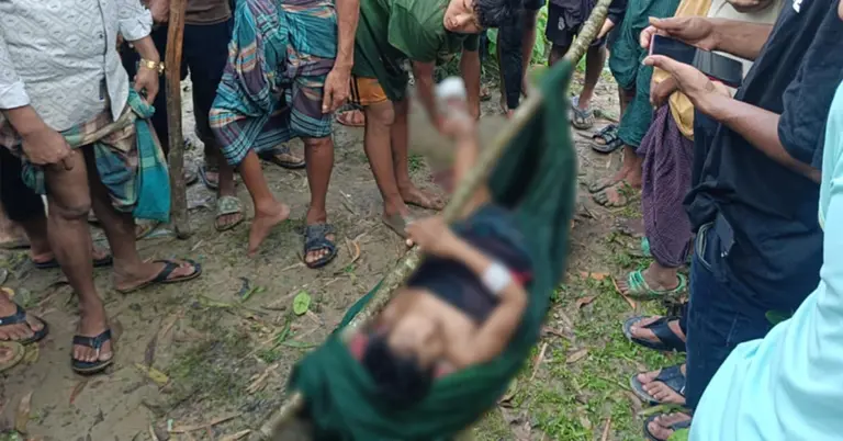 মাইন বিস্ফোরণে আহত যুবক